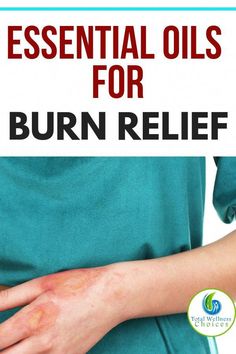 Discover the best essential oils for burns to help relieve pain caused by the burn, speed up the healing process and reduce scarring. Essential Oil Burn Relief, How To Help A Burn On Hand, Home Remedy For Burns Hands, Diy Burn Relief, Burn Relief Hand, Burn On Hand, Essential Oil For Burns, Home Remedies For Burns, Burn Remedy