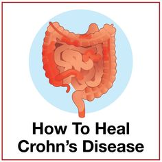 Chrones Disease Diet, Chrones Disease, Crohns Symptoms, Chrons Disease, Crohns Recipes, Heal Your Gut, Anti Inflammation Recipes, Anti Inflammation