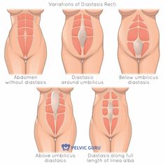 an image of the different stages of diapering in women's butts