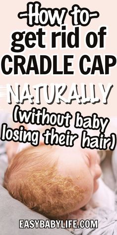 a baby laying down with the words how to get rid of cradle cap naturally without baby losing their hair