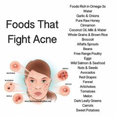 foods that fight acne Acne Safe Foods, Clear Skin Care, Haut Routine, Face Skin Care Routine, Clear Skin Tips, Healthy Skin Tips