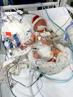 a baby in a hospital bed with an iv