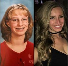 Bad Highlights, Transformation Pictures, Braces Off, Bad Teeth, Regular People, Nice Teeth, Best Eyebrow Products, Glamour Shots