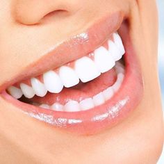 Teeth Whitening Dentist, Teeth Whitening Procedure, Dental Implants Cost, Perfect Teeth, Smile Makeover, Dental Cosmetics, Best Teeth Whitening, Stained Teeth