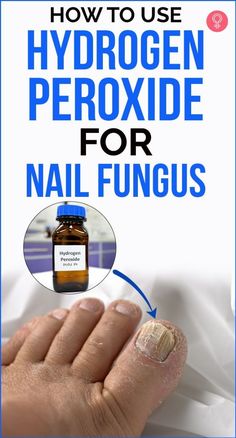 Choose the Right Concentration  Use a 3% hydrogen peroxide solution, which is commonly available in stores. Higher concentrations could irritate the skin and should be avoided. Pour enough hydrogen peroxide into a bowl to cover the affected nails. Soak your nails for 15-20 minutes. Do this daily for the best results. Rinse your nails thoroughly afterward and dry them well to prevent further fungal growth. Use as a Paste (Optional)  Mix hydrogen peroxide with baking soda until it forms a paste. Apply this paste directly to the affected nail, let it sit for about 10-15 minutes. Apply with Cotton  Soak a cotton ball in hydrogen peroxide and press it gently against the affected nail. Leave it on for 5-10 minutes, and repeat this process twice daily.#NailFungusTreatment #HealthyNails Peroxide Uses