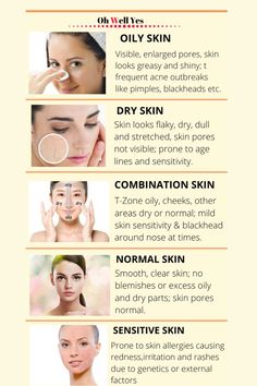 How to Determine Your Skin Type and Choose the Right Products Haut Routine, Skin Facts, Skin Advice, Skin Care Routine Order, Dry Skin On Face, Types Of Skin, Skin Allergies, Body Scrubs, Dry Skin Care