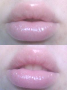 Lip Filler, Lip Shapes, Angel Aesthetic, Perfect Lips, School Looks, Porcelain Doll, Lip Plumper, Pink Lips