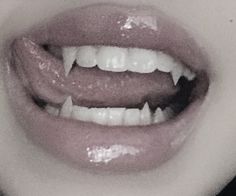 a woman's mouth with white teeth and gums