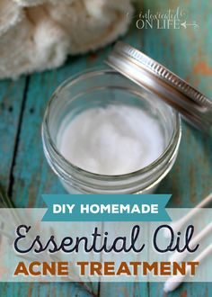 {DIY} Homemade Essential Oil Blemish Treatment Doterra Acne, Homemade Essential Oils, Coconut Oil For Acne, Homemade Essential Oil, Diy Acne, Home Remedies For Acne, Acne Cream