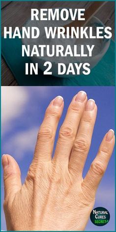 Remove Wrinkles From Hands, Blond Cenușiu, Home Remedies For Wrinkles, Wrinkles Hands, Skin Care Remedies