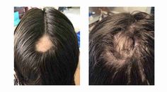 hair test results women Hair Test, Female Hair, New Hair Growth, Test Results, Hair Control, Lost Hair, Hair Regrowth, Hair Health, Grow Hair