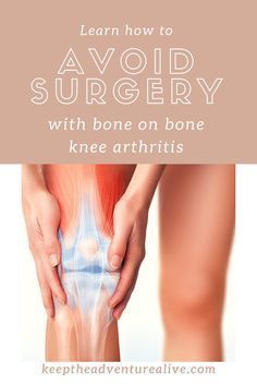 Exercises For Arthritic Knees, Knee Replacement Surgery Recovery, Knee Replacement Exercises, Knee Exercise, Knee Pain Relief Remedies, Knee Pain Relief Exercises, Knee Relief, Fish Oil Supplements, Bad Knee Workout