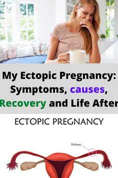 a woman sitting at a table with her stomach exposed and the words, my ectopic pregnant symptoms, cause recovery and life after