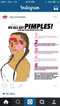 Pimple chart Doterra Acne, Skin Care Routine For 20s, 1000 Calories, Beauty Tips For Face, Natural Therapy, Face Scrub, Skin Care Acne, Diy Beauty, Apple Cider