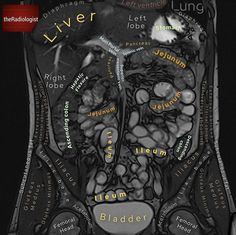 an x - ray shows the location of the liver and its surrounding structures, as well as other medical information