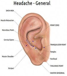 The Western Medical world tells us: "Headaches can be managed with proper diagnosis and medication." Well, "management" comes with some side effects: Ear Acupressure Points, Ear Diagram, Ear Reflexology, Ear Seeds, Shiatsu Massage Acupressure, Acupuncture Points, Acupressure Points