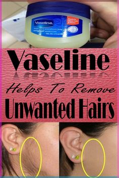 Vaseline Helps To Remove Unwanted Hairs #health #healthyskin #skin #skincare #fitness #vaseline #vaselinetips #beauty #beautytips Face Wrinkles Anti Aging, Hair Removal Diy, Botox Alternative, Remove Unwanted Hair, Anti Wrinkle Skin Care, Aesthetic Skincare, Wax Strips, Hair Removal Methods, Skin Care Wrinkles