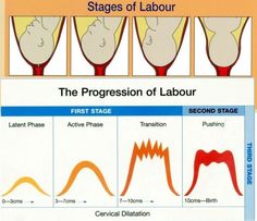 stages of labor the progression of labor