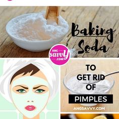 Deep Pimple, Pimple Mask, Aloe Vera Recipes, Dry Out Pimples, Blake Mitchell, Pimples On Forehead, How To Clear Pimples, Get Rid Of Pimples, Blind Pimple