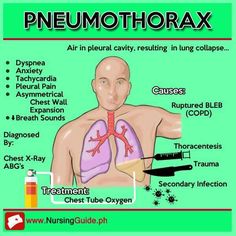 the diagram shows how to use an inhalet tube for breathing and other medical purposes