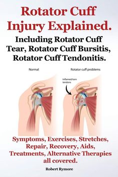 Shoulder Rehab Exercises, Rotator Cuff Exercises, Shoulder Pain Exercises, K Tape, Shoulder Rehab, Rotator Cuff Tear, Shoulder Impingement, Rotator Cuff Injury, Shoulder Pain Relief