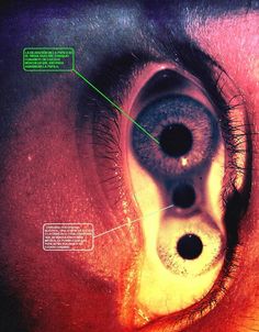 an image of the inside of a human eye with labels on its iris and part of it labeled