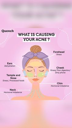 Acne Korean Skincare, Poor Digestion, Brown Spots On Face, Spots On Face, Skin Discoloration, Hormone Imbalance, Brown Spots, Skin Concern, Simple Tricks