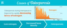 Osteoporosis Symptom Information | Menopause Now Calcium Supplements