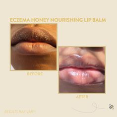 Eczema Honey Nourishing Lip Balm gives you a much needed nourishment for dry and chapped lips. With power packed ingredients to richly moisturize and a refreshing hint of mint and lime, our balm will keep your lips soft, smooth, and healthy. What makes this different? We honor the super ingredients beeswax and honey to provide a protective shield over your lips that actually stays put and lasts.Eczema Honey Nourishing Lip Balm is an easy on-the-go addition to refresh and renew your lips with dee Alum Uses, Face Body Scrub, Lime Essential Oil, Soften Lips, Healthy Advice, Clearer Skin, Perfect Lips, Chapped Lips, Peppermint Essential Oil