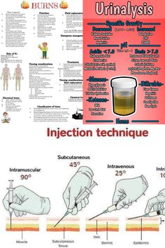 Burns Nursing, Studying Nursing, Nursing School Essential, Lpn Nursing, Nursing School Studying, Nursing School Notes, Nursing Degree, Nclex