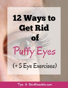 Dry Eyes Causes, Simple Beauty Tips, Swollen Eyes, Eye Puffiness, Irritated Eye, Eye Infections, Eye Exercises, Under Eye Puffiness, Eyes Problems