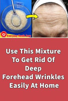 Are you looking for How To Get Rid Of Wrinkles On Forehead? We will share with you How To Get Rid Of Wrinkles On Forehead with a natural mixture. This mixtur... Deep Forehead Wrinkles, Face Wrinkles Remedies, Home Remedies For Wrinkles, Anti Aging Remedies, Homemade Wrinkle Cream, Get Rid Of Wrinkles, Wrinkle Remedies, Wrinkle Free Skin, Forehead Wrinkles