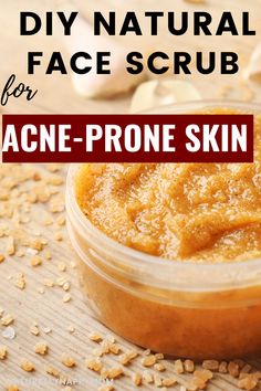 Diy Body Scrub For Acne, Acne Body Scrub, Natural Face Scrub For Acne, Diy Acne Scrub, Facial Scrubs Diy Exfoliating For Acne, Diy Face Scrubs For Acne, Face Scrubs For Acne, Face Soap For Acne, Best Facial For Acne