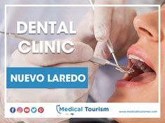 Schedule an appointment with one of the top dental procedures in Nuevo Laredo for Medical Tourism.
Visit the link below for more information! Best Dental Implants, Dental Implant, Dental Health