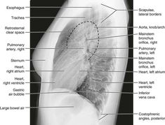 an x - ray shows the location of the bones in the lower limb and upper limb