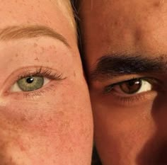 two people with freckles on their faces are looking at the camera