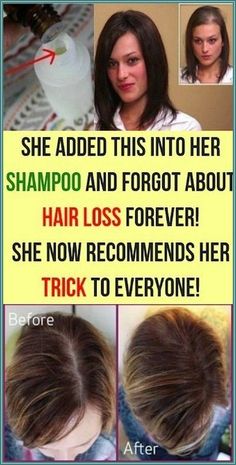 She Added This into Her SHAMPOO and Forgot About Hair Loss FOREVER! She Now Recommends Her Trick Homemade Hair Shampoo, Grow Hair Faster, Hair Regrowth, Hair Maintenance