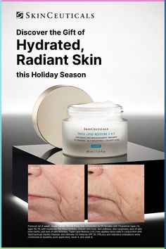 Discover Our Physician-Favorite Anti-Aging Moisturizer Cream, Triple Lipid Restore 2:4:2 Tighten Facial Skin, Ootd Instagram, Forehead Wrinkles, Anti Aging Moisturizer, Winter Skin, Anti Aging Cream, Uneven Skin, Flawless Skin, Uneven Skin Tone