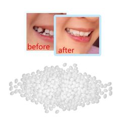 snorda Temporary Tooth Repair Kit Teeth And Gaps FalseTeeth Solid Glue Denture Adhesive - Walmart.com Broken Teeth, Dental Restoration, Veneers Teeth, Diy Teething