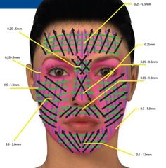 dermapen microneedling NYC Dermapen Microneedling, Skin Needling, Derma Pen, Facial Aesthetics, Cosmetic Treatments, Beauty Treatments, Facial Care