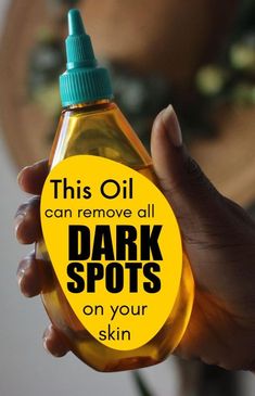 Oil that will remove all dark spots on your skin #skin #skincare #aging #beauty #beautytips #tips #beautyhacks Skincare Aging, Dark Spots On Legs, Aging Beauty, Brown Spots Removal, Brown Spots On Face, Dark Spots On Skin, Skin Spots, Spots On Face, Remove Dark Spots