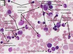 the cells in this cell are labeled with different types of nematrolides