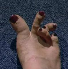 Trendy Nail Ideas Funny Feet Nails, Toe Pictures Ideas, Feet Nails Ideas, Gross Nails, Sus Pics, Ugly Toes, Ugly Legs, Da Fuq