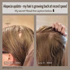 Want Thicker, Fuller Hair? Here’s How!
🌿 Ready to start growing your hair the right way? Or dreaming of adding 4 inches in just a week? Look no further! 👇
Click the link in our bio to discover everything you need for hair growth success.
Imagine this: long, luscious hair, a secret formula 😮 for rapid growth, and tons of bonus tips and guides. You'll start strong and finish even stronger! 💪
#hair, #haircolor, #hairstyles, #hairbeauty, #hairstyle, #haircolorideas, #hairideas, #hairmakeup, #haircolorideasforbrunettes, #haircolors, #haircoloring, #hairnails, #haircut, #hairstyling, #hairandnails, #haircare, #haircuts, #hairinspiration, #hairon, #hairtutorial, #haircolour, #haircutting, #hairdo, #hairlength, #hairstylesforshorthair For Fast Hair Growth, Cute Hairstyles For School, Mid Length Hair With Layers, Medium Length Hair With Layers, Long Layered Haircuts, Cute Hairstyles For Medium Hair