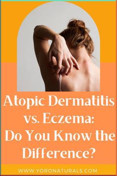 Discover the best eczema-friendly clothing, natural skin care products, and at-home remedies to soothe your eczema or atopic dermatitis. Great skin care ideas for adults and kids alike! Itchy Skin Remedy, Skin Care Ideas, Natural Skin Care Products, Great Skin, Essential Oils For Skin, Acne Solutions, Holistic Beauty, Skin Remedies, Cruelty Free Skin Care