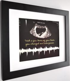 a black and white photo hanging on the wall next to a framed poster with an image of a woman's breast