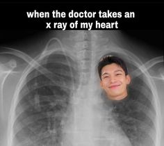 an x - ray image with the caption when the doctor takes an xray of my heart