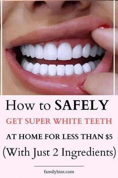 Tooth decay remedies Whiten Teeth Naturally, Whiten Your Teeth At Home, Teeth Whiting At Home, Teeth Whitening Homemade, Teeth Whitening Remedies, Teeth Whitening Diy, Whiten Your Teeth, Whitening Products, Whiten Teeth