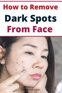 Black Spots On Face, Get Rid Of Pores, Age Spots On Face, Lighten Scars, Natural Beauty Treatments, Natural Mask, Dark Spots On Face