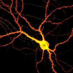 an image of the inside of a nephoidic cell, with bright yellow and red lights